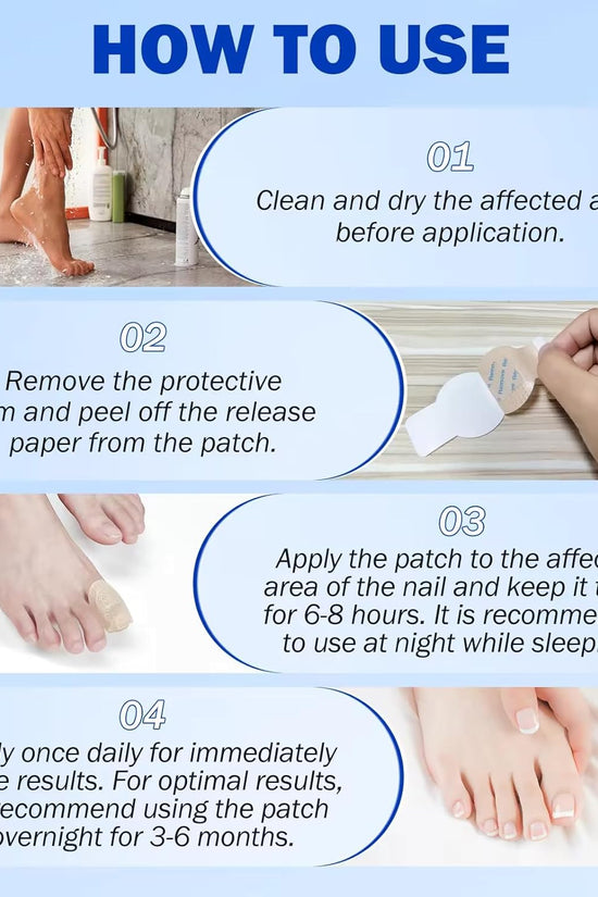 Nighttime Renewal Fungal Nail Patches