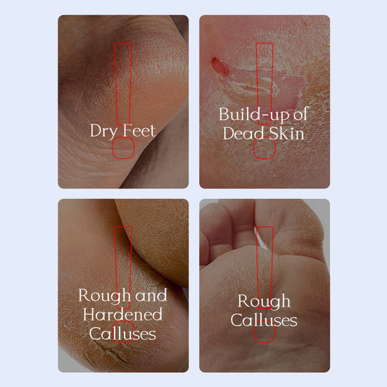 PEEL OFF FOOT MASK (Pair) IMPORTED
