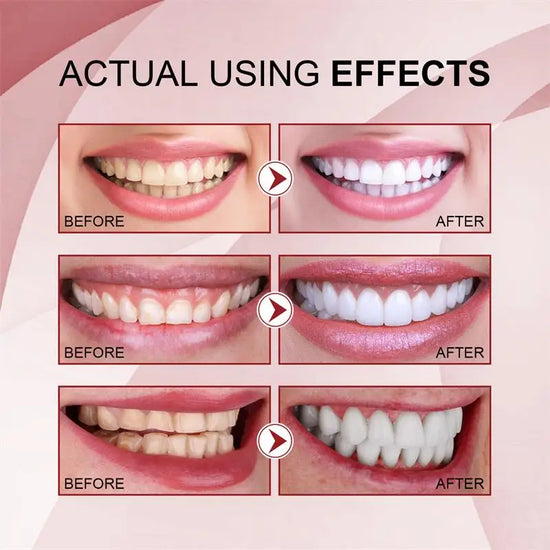 Niacinamide Whitening Toothpaste