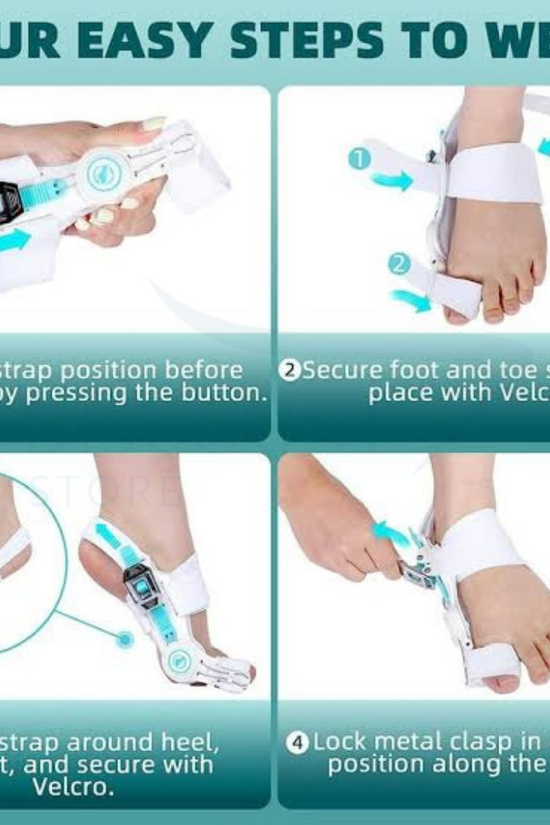 Pain Relief Bunion Toe Corrector - (IMPORTED W/O KNOB)