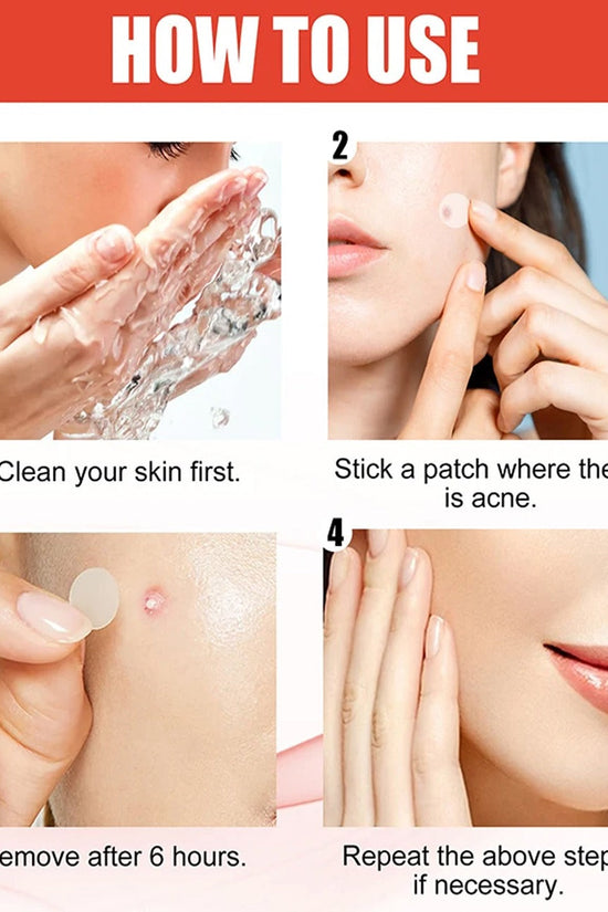 Hydrocolloid Pimple Patch